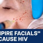 Three Women Infected with HIV After Vampire Facials in U.S America | Vantage…. 04-29-2024