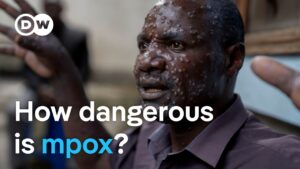 New mpox virus: Why is it spreading so quickly? | 08-15-2024