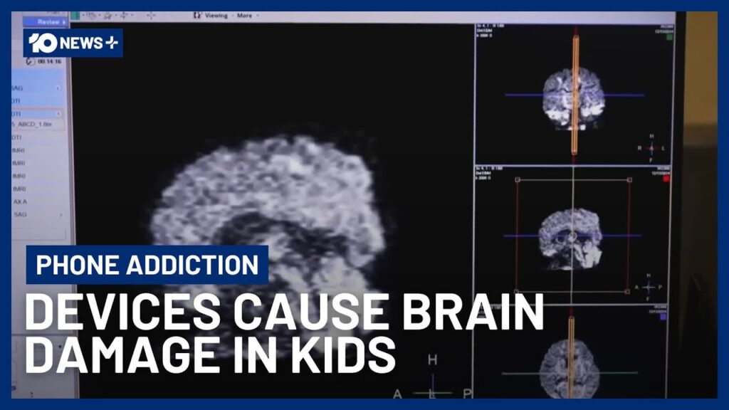 Chilling Warning for Parents as MRI Scans Show Phones Are Damaging Kid’s Brains | 10 News…. 02-02-2026